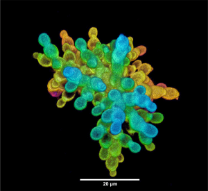 Snowflake yeast (Courtesy of Shane Jacobeen, Peter Yunker & Will Ratcliff